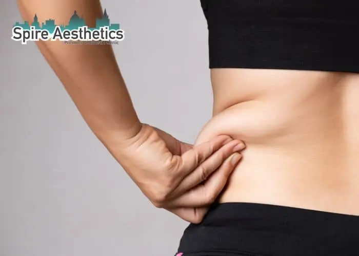 Image of woman pinching fat on their hips Biggleswade. Fat Freezing treatment