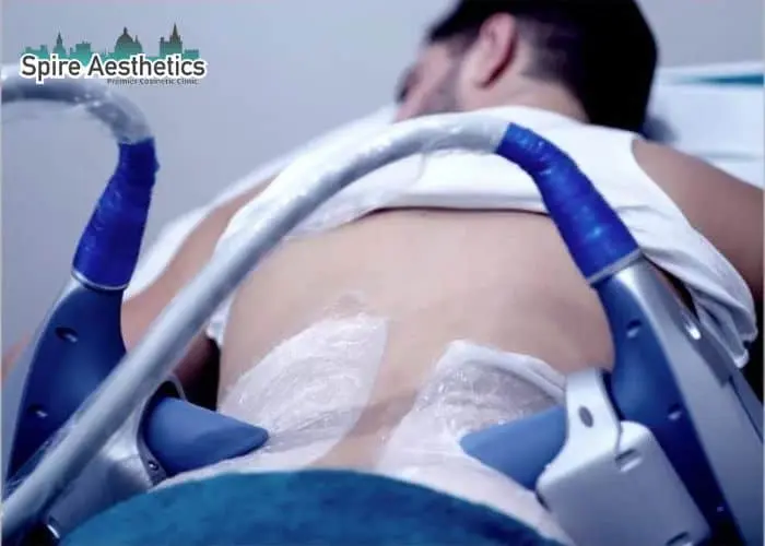 Man having fat freezing treatment done on love handles before a competitions Biggleswade to create a sculpted look.