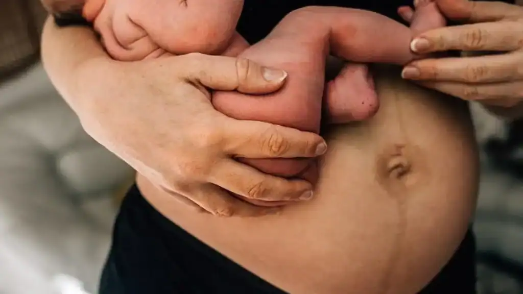 Why Is My Stomach Still Big After Pregnancy Biggleswade?